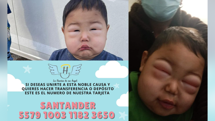 Rara enfermedad afectó a bebito de 2 años en Coahuila: Solicitan ayuda para seguir su tratamiento