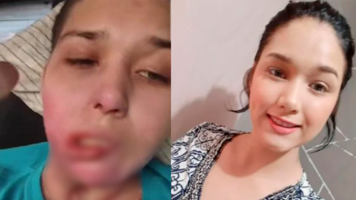 Tres hombres la quemaron y abusaron de ella: Elvia exige justicia en Nuevo León