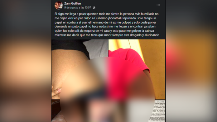 'Decía que tenía que morir': Hombre atacó a su ex cuñada en Coahuila