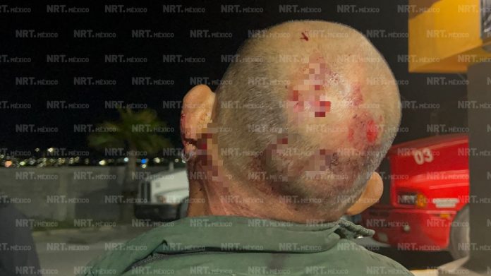 Le abren la cabeza de un machetazo