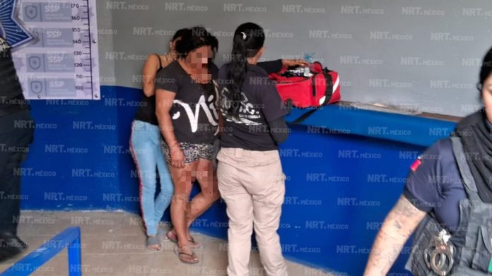 Le deja fractura de tabique nasal a su pareja