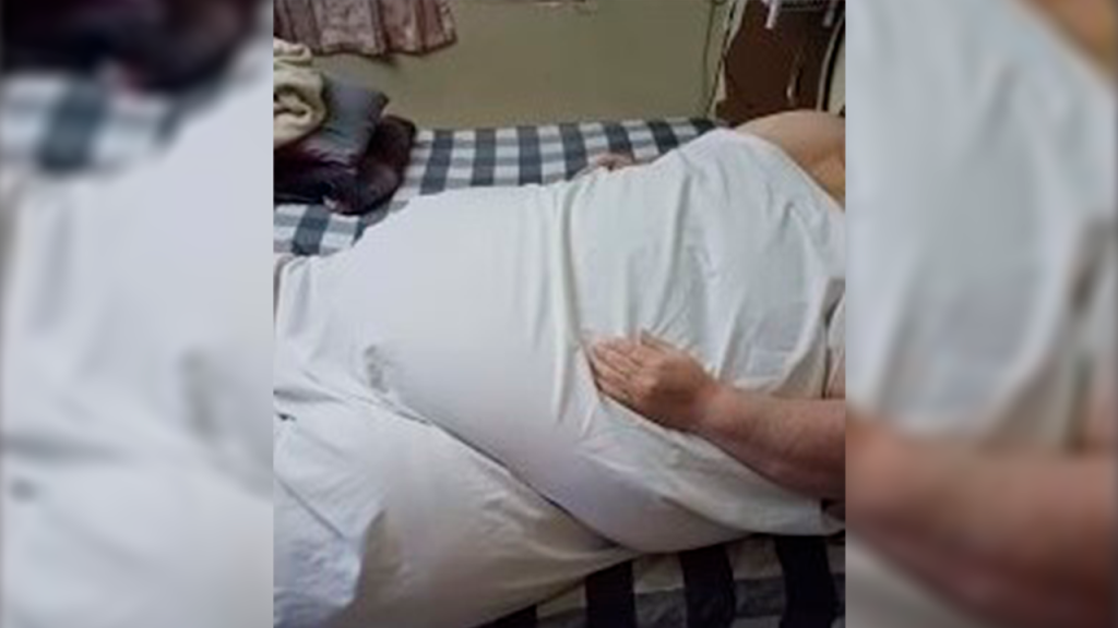 Claudio, un hombre de Torreón que pesa más de 300 kilos, pide ayuda para su esposa
