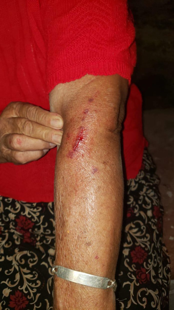 Con heridas en brazos resultó la señora lesionada