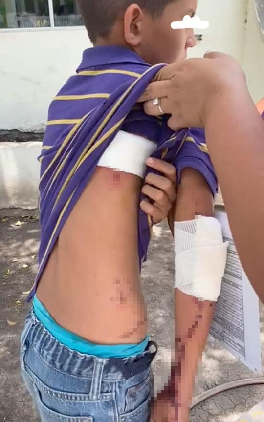 Niño herido tras volcadura en carretera a Múzquiz