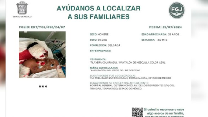 Emiten alerta para encontrar familiares de hombre hallado sin mano, oreja y nariz