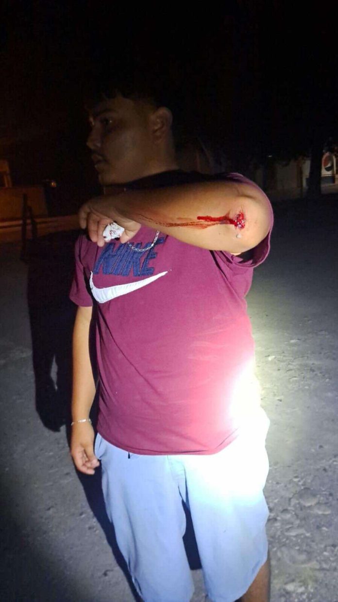 Pandilleros golpearon a un menor en la carbonífera