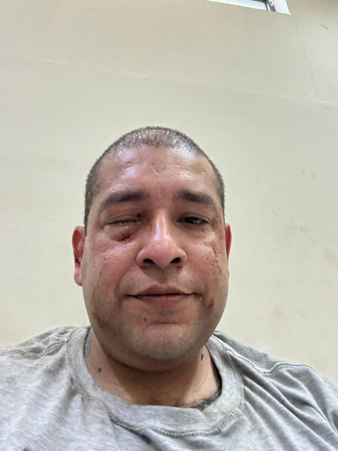 El enfermero del IMSS y comerciante resultó lesionado