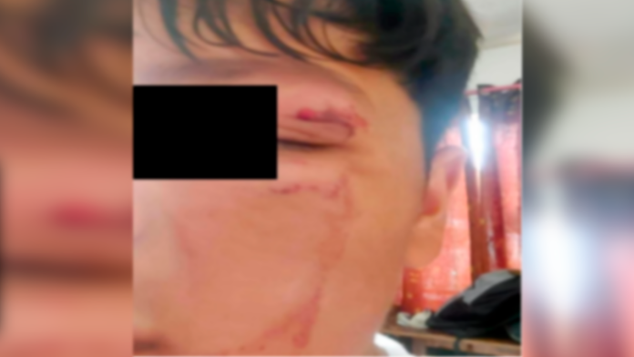 ¡Lo agarró a golpes!: Estudiante de secundaria es agredido por un desconocido en Coahuila
