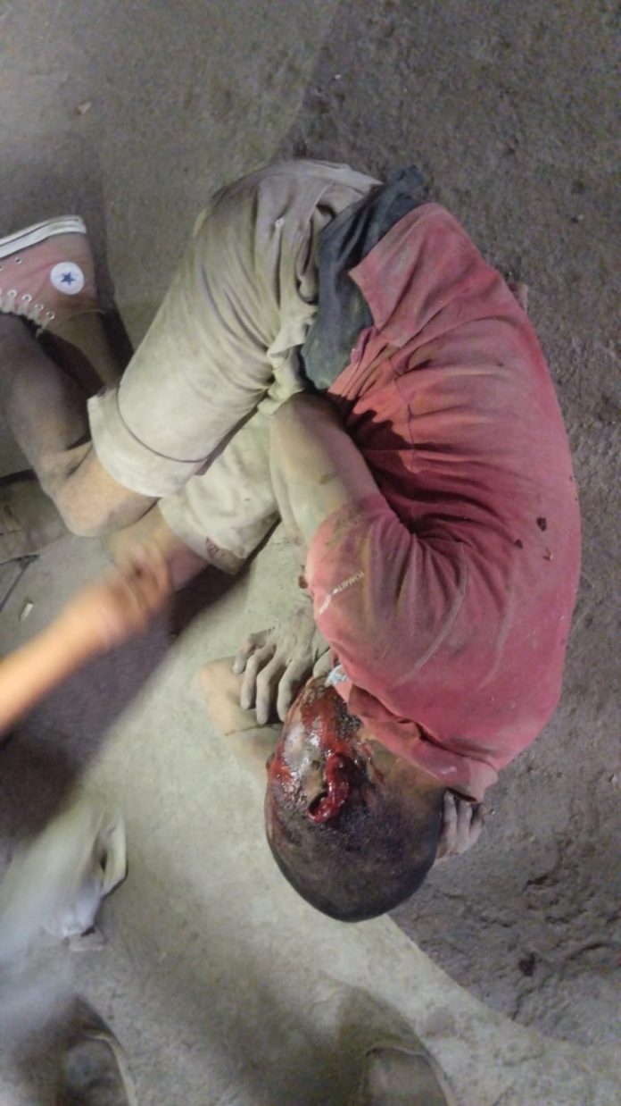 Lesionado en agresión en Nueva Rosita