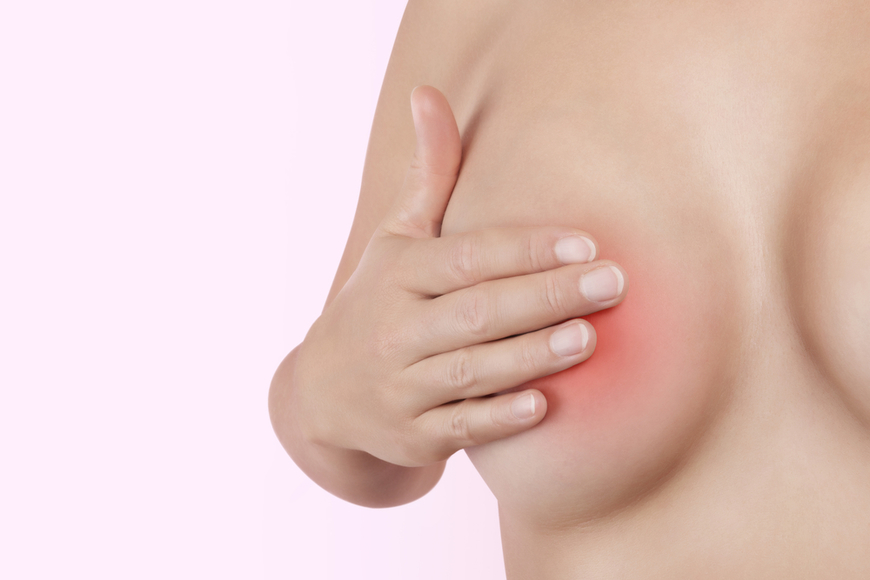 Atienden a más de mil mujeres con síntomas de cáncer de mama