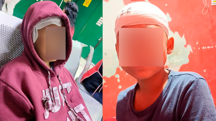 Piden apoyo urgente para Emiliano; buscan cubrir estudios de tumor benigno en los huesos de la cara y el cráneo