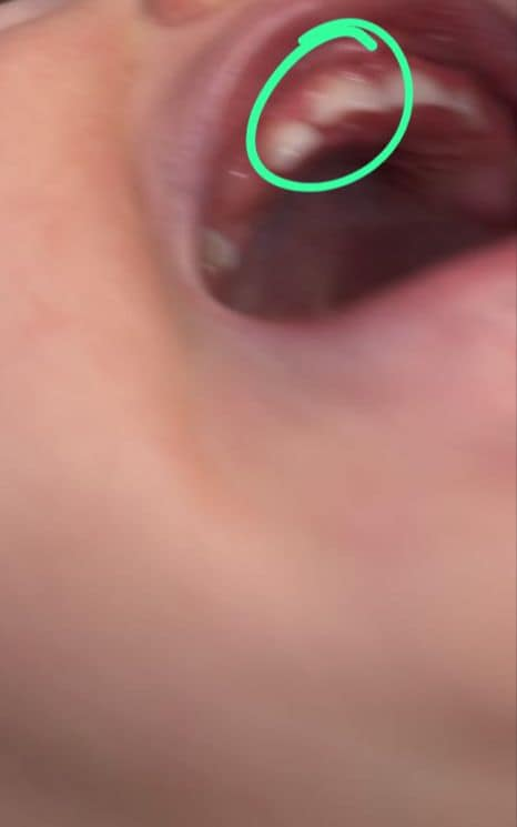 Investigan abuso sexual de bebé en guardería: ¡Revisión médica lo confirmó!