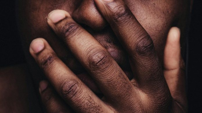 Madre usó crema para aclarar la piel de sus hijos; ahora sufren quemaduras y cicatrices