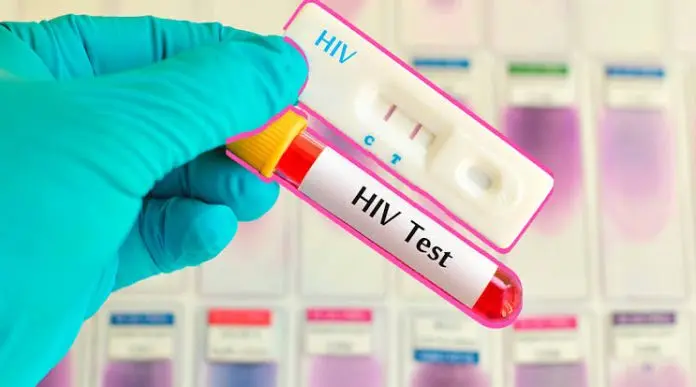 Coahuila registra 80 casos de VIH