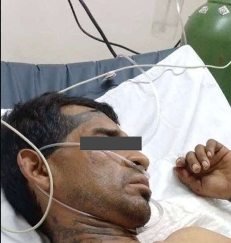 El lesionado fue trasladado al centro de salud en Sabinas