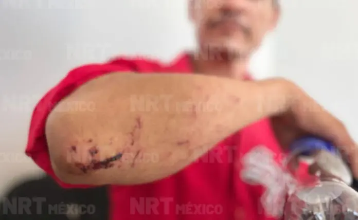 Vecino de Múzquiz es agredido y denunciado tras recuperar bicicleta robada