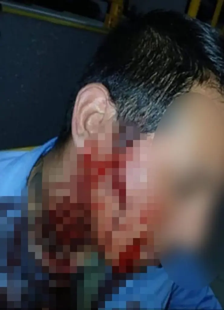 Chofer herido
