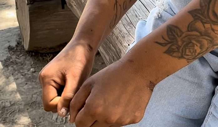 las lesiones en sus muñecas