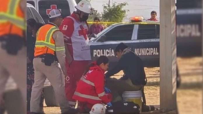 Menor con síndrome de Down