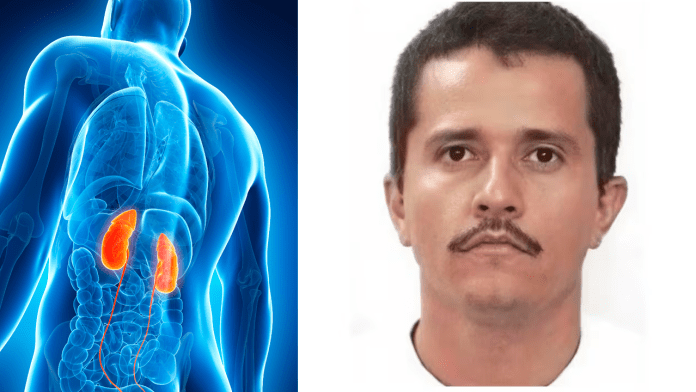 El Mencho padecía insuficiencia renal