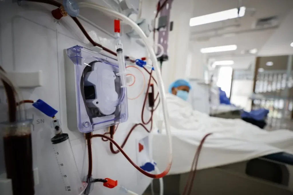 Brinda HRAE del ISSSTE en Acapulco atención especializada en salas de hemodiálisis y hemodinamia