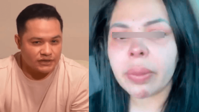 Rafael González de Los Recoditos