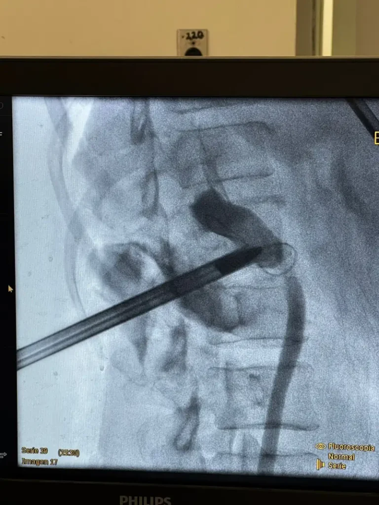 Por primera vez en la región, Hospital Regional del ISSSTE Mérida realiza jornada quirúrgica de urología