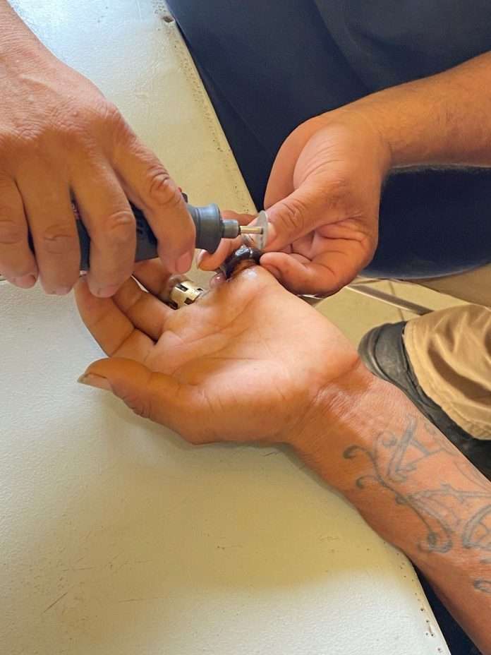 Elementos de Protección Civil de Múzquiz auxiliaron a un hombre de 32 años para retirar un anillo encarnado que le provocaba intenso dolor en uno de sus dedos.