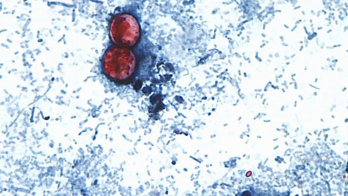 Confirman primeras muertes por brote de ciclosporiasis en Michigan