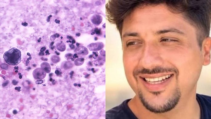 ‘Ameba comecerebros’ causa su primera muerte documentada en Yucatán